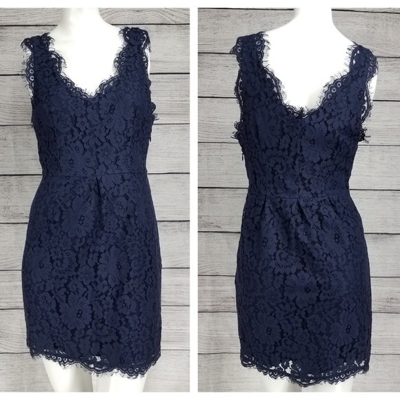 Joie Dresses & Skirts - Joie XS Rori Mini Dress Eyelash Scalloped Lace